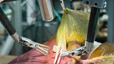 Robô cirurgia- Juo-Tung Chen- Universidade Johns Hopkins